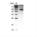 Human Noggin protein, His tag (Animal-Free)