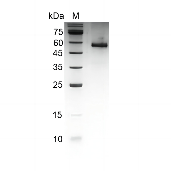 Human Noggin protein, His tag (Animal-Free)
