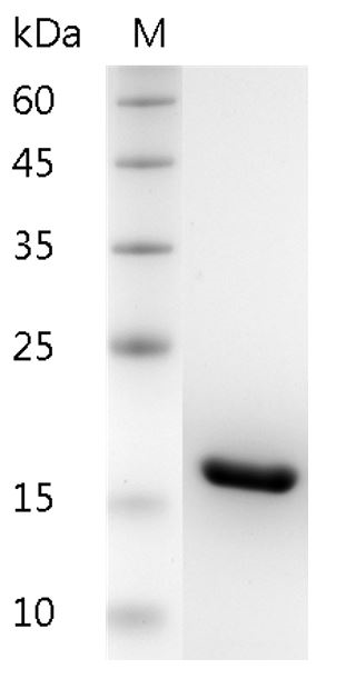 Human IL-1? protein, His tag (Animal-Free)