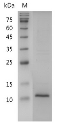 Human ?-NGF protein, His tag (Animal-Free)