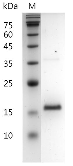 Human FGF-2?154 aa?protein, His tag (Animal-Free)
