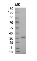 Human Haptoglobin Protein, His tag