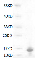 Human S100A9 Protein