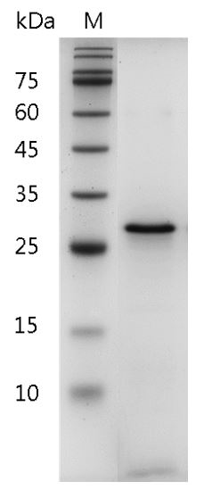 Human Galectin-3 Protein, His tag (Animal-Free)