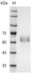 Human RSPO1/R-spondin 1 Protein, His-SUMO tag (Animal-Free)