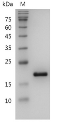 Human IL-1RA Protein, His tag (Animal-Free)