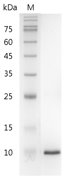 Mouse ?-NGF protein, His tag (Animal-Free)