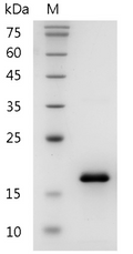 Mouse CCL2 protein , His tag (Animal-Free)