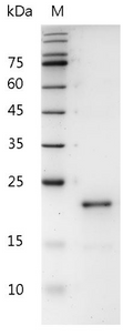 Human IL-28B Protein, His tag (Animal-Free)