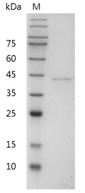Mouse IL-12 p40 Protein, His tag (Animal-Free)