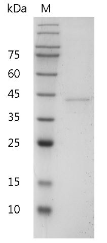 Mouse IL-12 p40 Protein, His tag (Animal-Free)