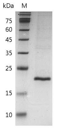 Mouse TNF beta Protein, His tag (Animal-Free)