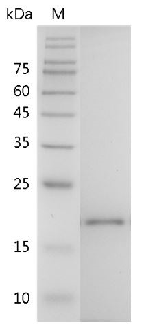 Mouse IL-38 Protein, His tag (Animal-Free)