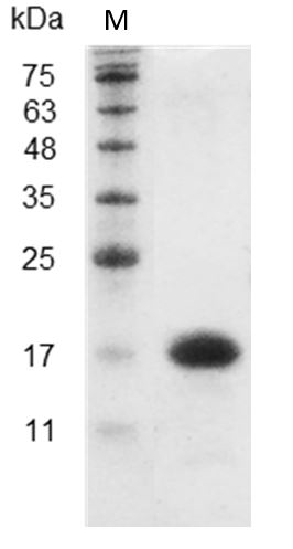 Mouse IL-16 Protein, His tag (Animal-Free)