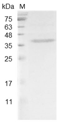 Mouse HDGF Protein, His tag (Animal-Free)