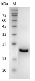 Mouse G-CSF Protein, His tag (Animal-Free)