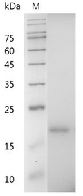 Mouse CXCL12 Protein, His tag (Animal-Free)