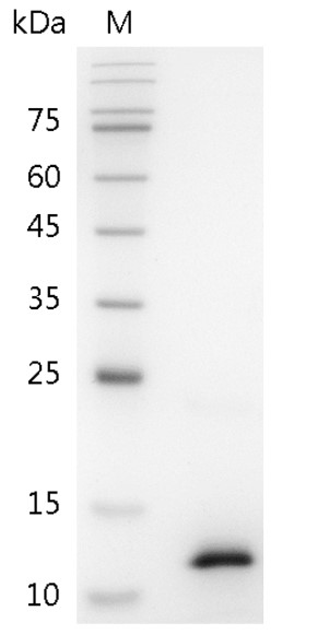 Mouse CCL3 Protein, His tag (Animal-Free)