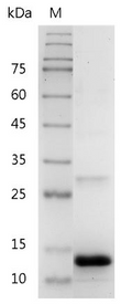 Human Activin B Protein, His tag (Animal-Free)