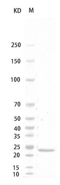 Ratÿ G-CSF Protein, His tag