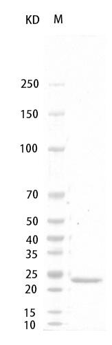 Ratÿ G-CSF Protein, His tag