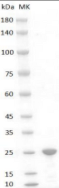 Human FGF-19 Protein, His tag