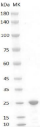 Human FGF-19 Protein, His tag