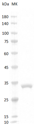 Mouse Adiponectin Protein, His tag