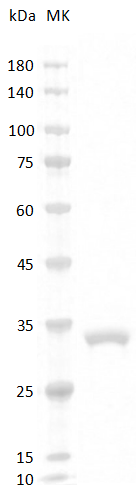 Mouse Adiponectin Protein, His tag