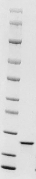Mouse Oncostatin M (OSM) Protein