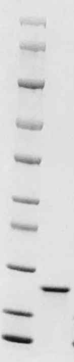 Mouse Oncostatin M (OSM) Protein