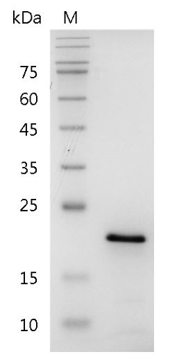 Human FGF-10 Protein, His tag (Animal-Free)