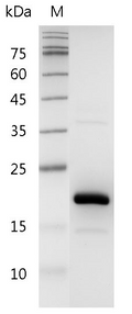 Human FGF-4 Protein, His tag (Animal-Free)