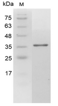 Human Galectin-4 Protein, His tag (Animal-Free)