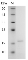 Human Galectin-10 Protein, His tag (Animal-Free)