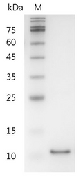 Human IL-5 Protein, His tag (Animal-Free)