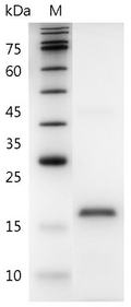 Human IL-19 Protein, His tag (Animal-Free)