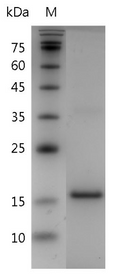 Human IL-24 Protein, His tag (Animal-Free)