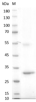 Human Noggin Protein, His tag