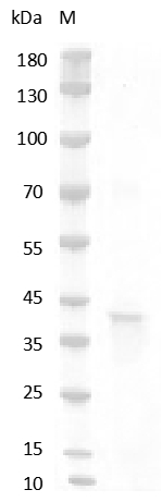 Human RSPO1/R-spondin-1 Protein