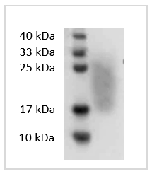 Human GM-CSF Protein, His tag (Animal-Free)