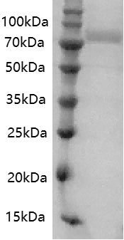 Human Transferrin Protein, His tag