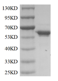 Terminal Deoxynucleotidyl Transferase (TdT)