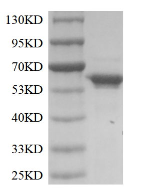 Terminal Deoxynucleotidyl Transferase (TdT)