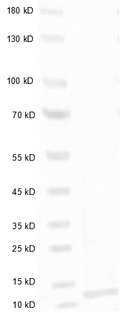 Vibriocholerae Toxin B Protein