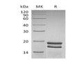 Recombinant Human SUMO1 Protein (His Tag) – Figure 1 of 2