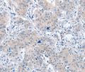 PARD6A Polyclonal Antibody – Figure 1 of 3