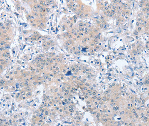 PARD6A Polyclonal Antibody – Figure 1 of 3