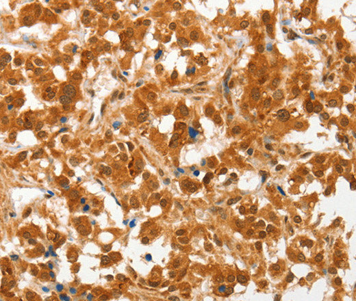 COL4A3BP Polyclonal Antibody – Figure 1 of 3