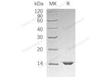 Recombinant Human Mitochondrial Fission 1 Protein/FIS1 Protein (His Tag) – Figure 1 of 2